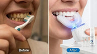 360° Intelligent Electric Toothbrush – Waterproof U-Shape Automatic Whitening Toothbrush Vogueen